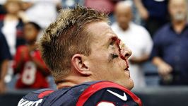 Watt